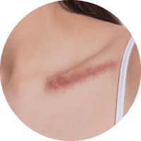 凝血功能異常者