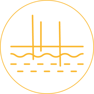 高能量聚焦超聲波