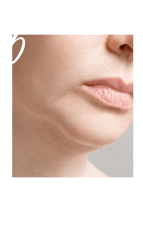 頸、面肌膚鬆弛